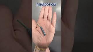 Petardos Chen chins- Petados CM