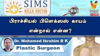 Live | பிராச்சியல் பிளெக்ஸஸ் காயம் என்றால் என்ன? | Dr. Mohamed Ibrahim BK | SIMS