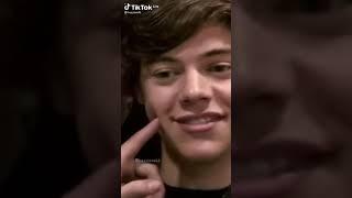 Harry Styles Fetus Dimples #shorts
