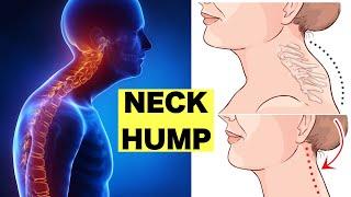 How to Fix a Neck Hump and Slim Face｜can be done while sitting