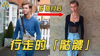 減肥成癮的男人，瘦成骷髏了還要繼續減！！｜減肥｜肥胖｜Joey Turner｜明星觀察員