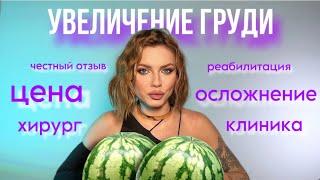 УВЕЛИЧЕНИЕ ГРУДИ | честный отзыв | мой опыт | хирург | стоимость