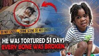 This Case Is So Gruesome Most People Can't Finish It! Incredible Injuries, Like After a Tornado!