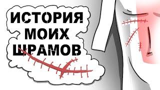 ПОКАЗЫВАЮ ШРАМЫ и ИХ ИСТОРИИ