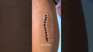 How stitches work | Fact Fusion #science #shorts #viralshort #factfusion