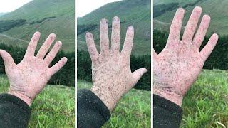 Giant Swarm Of Midges Stick To Hand In Scotland