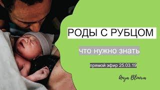 РОДЫ С РУБЦОМ | КАКИЕ РИСКИ?