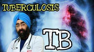 Tuberculosis - The Medical BASICS of TB explained | Dr.Education (Eng)
