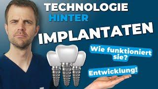 Die Technologie hinter Zahnimplantaten: Wie sie entwickelt wurden und wie sie funktionieren!