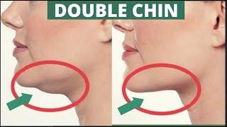 Lose Double Chin FAST with Face Yoga & Massage!  Sculpt Your Jawline in 2 Weeks! ‍️