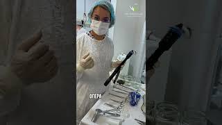 ЛОНГО - геморрой даволашнинг замонавий усули