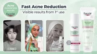  Celebrate Acne Awareness Month with Real Results 