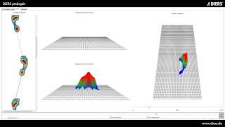 DIERS pedogait - Foot & Gait Analysis (Screenvideo)