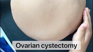 Playdough Surgery  - Ovarian Cystectomy - Part I