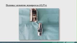 Reasons for revision arthroplasty in cancer patients (Aleksey Starodubtsev)