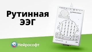 Проведение рутинного ЭЭГ обследования