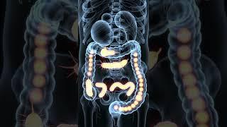 Ascariasis in the Human Digestive System | 3D Medical Animation of Intestinal Parasites