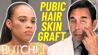 Dog Attack Survivor Left with Pubic Hair Growing on Her Face FULL TRANSFORMATION | Botched | E!