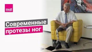 Современные протезы ног