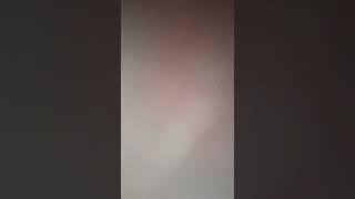 Очень сильно урчит животик 