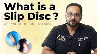 What is a Slip Disc? A Spine Surgeon Explains