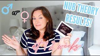 HOW TO GUESS YOUR BABY'S GENDER? NUB THEORY EXPLAINED AND MY RESULTS! 12 WEEK GENDER REVEAL!