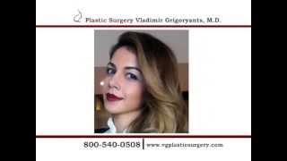 Dr. Vladimir Grigoryants, MD   rhinoplasty results and surgery reviews.