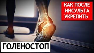 Как после инсульта укрепить голеностоп.