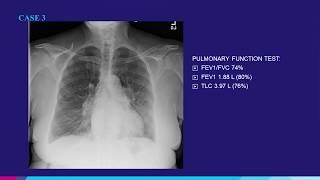 Pulmonary Case 3 Presented at RSNA 2018 | Konica Minolta Healthcare