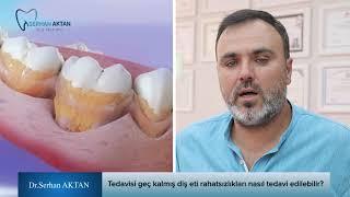 Tedavisi geç kalmış diş eti rahatsızlıkları nasıl tedavi edilebilir