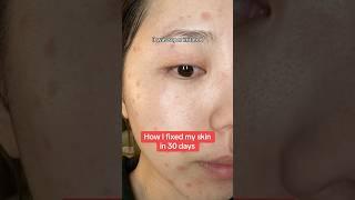 Fixed my skin in 30 days  #skincare #shorts