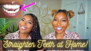 How to Fix Teeth at Home: Byte Journey| Affordable Quick & Easy| Impression Kit Demo| iamLindaElaine