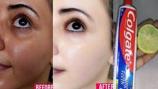 Colgate toothpaste for face whitening | Amazing colgate beauty hacks | Colgate and lemon face pack