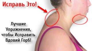 How to eliminate a hump on the neck at home (QUICKLY) | Fix it in 30 days!