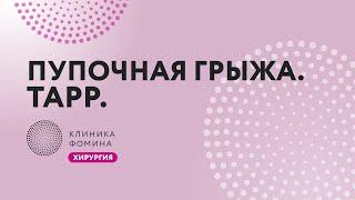 тестируем новые нитки и инструменты // пупочная грыжа ТАРР