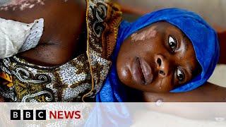 DR Congo war: Rape survivors recall horror of Goma jailbreak | BBC News