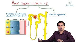 Fanconi syndrome / Proximal ( Type 2 ) Renal Tubular Acidosis - #Usmle