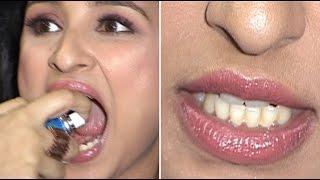 Parineeti Chopra Shows Off Her Dirty Yellow Teeth! OOPS SHE DID IT AGAIN…