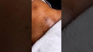 Brazilian Wax | Life as a Esthetician