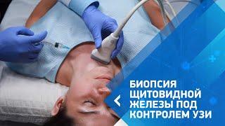 Пункционная биопсия щитовидной железы