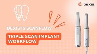 DEXIS™ IS ScanFlow Intraoral Scanning Software - Triple Scan Implant Workflow