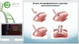 Забелин М В, Погосян Р Р - Варианты илеоцисто пластики при раке мочевого пузыря