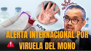 ALERTA INTERNACIONAL: La VIRUELA DEL MONO asoma como una "NUEVA PANDEMIA"