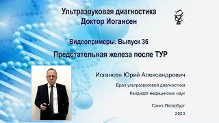 УЗИ. Доктор Иогансен. Видеопримеры. Выпуск 36. Предстательная железа после ТУР.