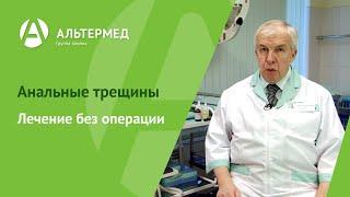 Лечение анальных трещин.