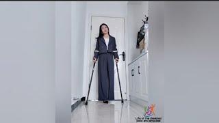 The beautiful woman has an amputated leg and lives with crutches #disabled