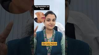 #pigmentation#pigmentationcream#skincare#trending #shorts#short#ytshorts#youtube#youtubeshorts#yt