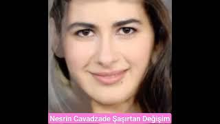 Nesrin Cavadzade İnanılmaz Değişim