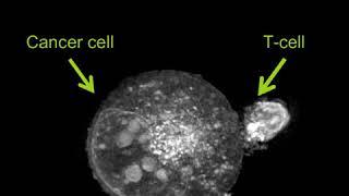 Label-free Live Cell Imaging: Activated T-Cell Killing Cancer Cell