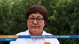 БЕШЕНАЯ ЛИСА ПОКУСАЛА РЕБЕНКА